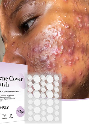Acne Patch Skin Care - 72 Pcs