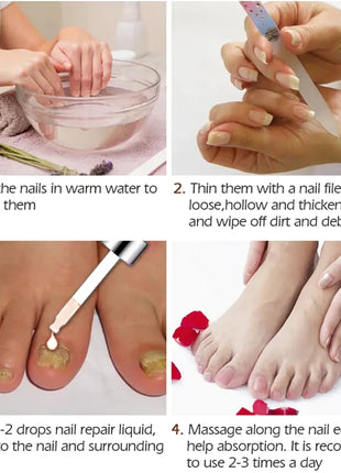 Nail Serum for Foot Care and Fungus Removal Gel
